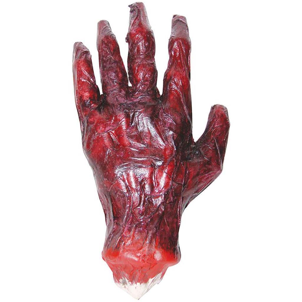 Burnt Hand 