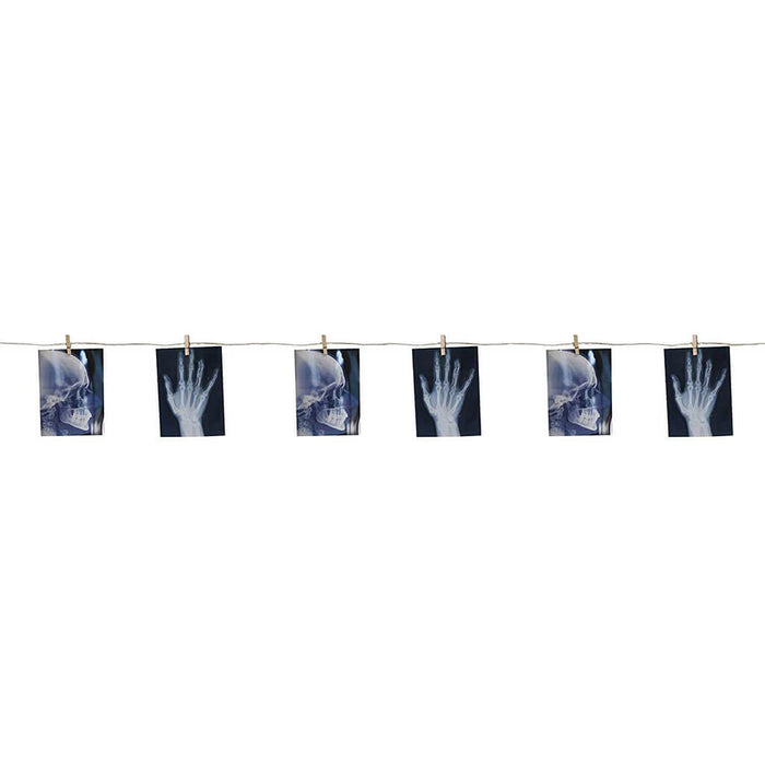 Xray Photos Bone Garland