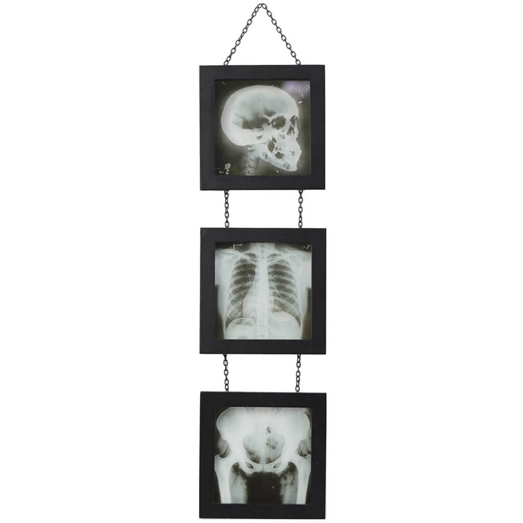 Xray Skeleton Glass Wall Decor